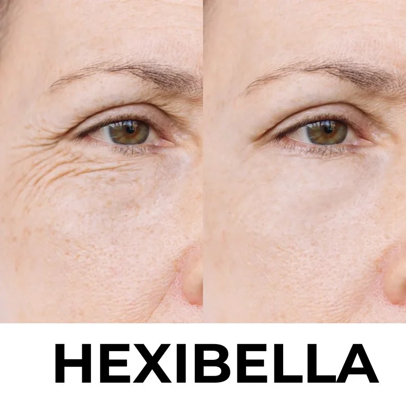 Hexibella rood licht apparaat