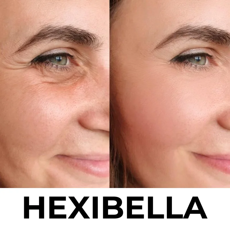 Hexibella rood licht apparaat