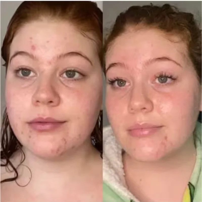 Hexibella Zijden Kussensloop