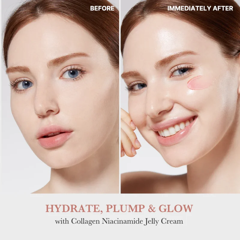 MicrosoftTeams-image_877 Collagen Niacinamide Jelly + Free Mask