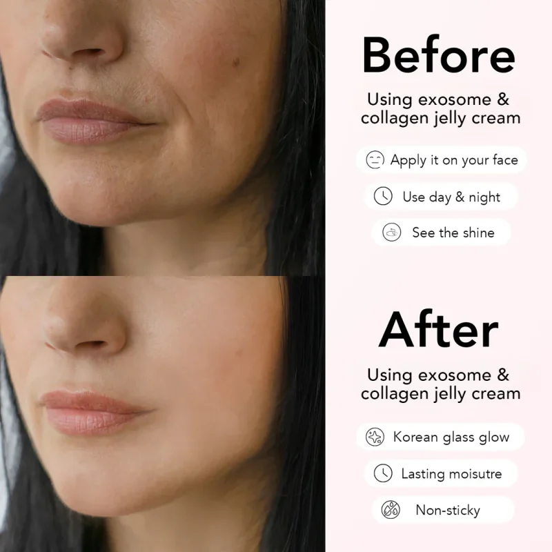 beforeafterjcream_99d7d4d3-7f08-43b2-bc83-db73bacf7413 Collagen Niacinamide Jelly + Free Mask