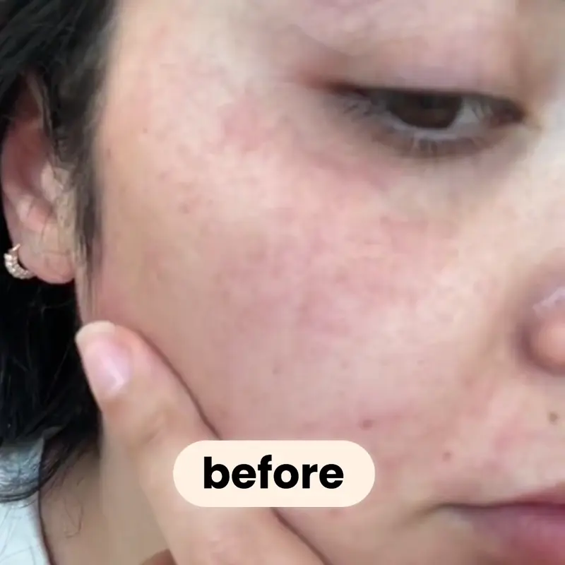 hexi Maschera coreana al bio-collagene